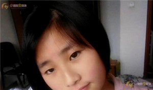 花季少女患罕见疾病 全国只有3例