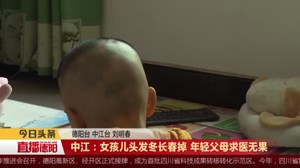 中江：女孩儿头发冬长春掉 年轻父母求医无果