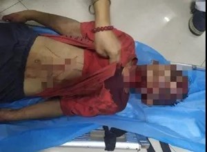 惊心！成都8岁男童被17岁男子绑走殴打！嫌疑人已被刑拘
