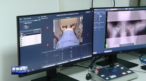 西南地区首台“精准智能放疗平台”在市医院投入使用
