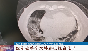 没发烧不咳嗽，一查双肺都白了！这些患者需要做CT